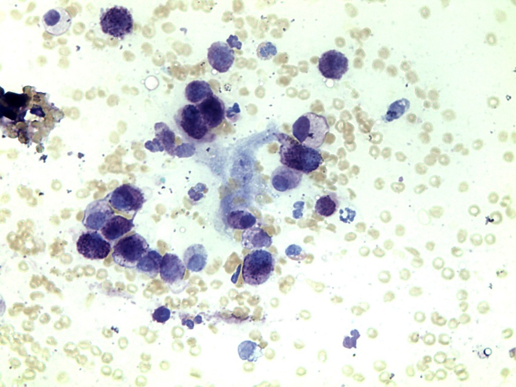 FNA　肥満細胞腫